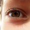 Παιδιά: Ποια αθλήματα είναι επικίνδυνα για τραυματισμό στα μάτια