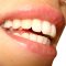 Λεύκανση δοντιών – Χαμογελάστε ξανά με αυτοπεποίθηση