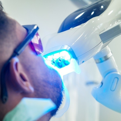 Λεύκανση Δοντιών με Laser: Σύγχρονες Τεχνικές -Top Αποτελέσματα